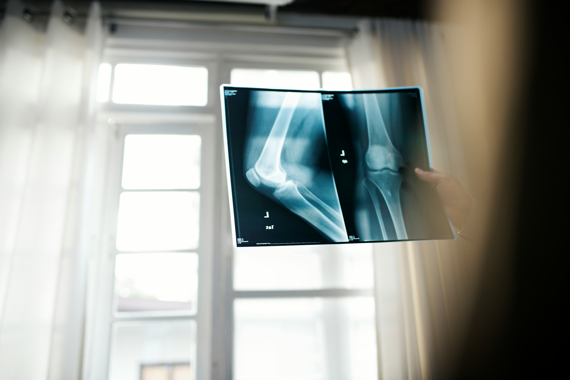 The Dangers of Keeping Old X-Rays at Home in Pompano Beach