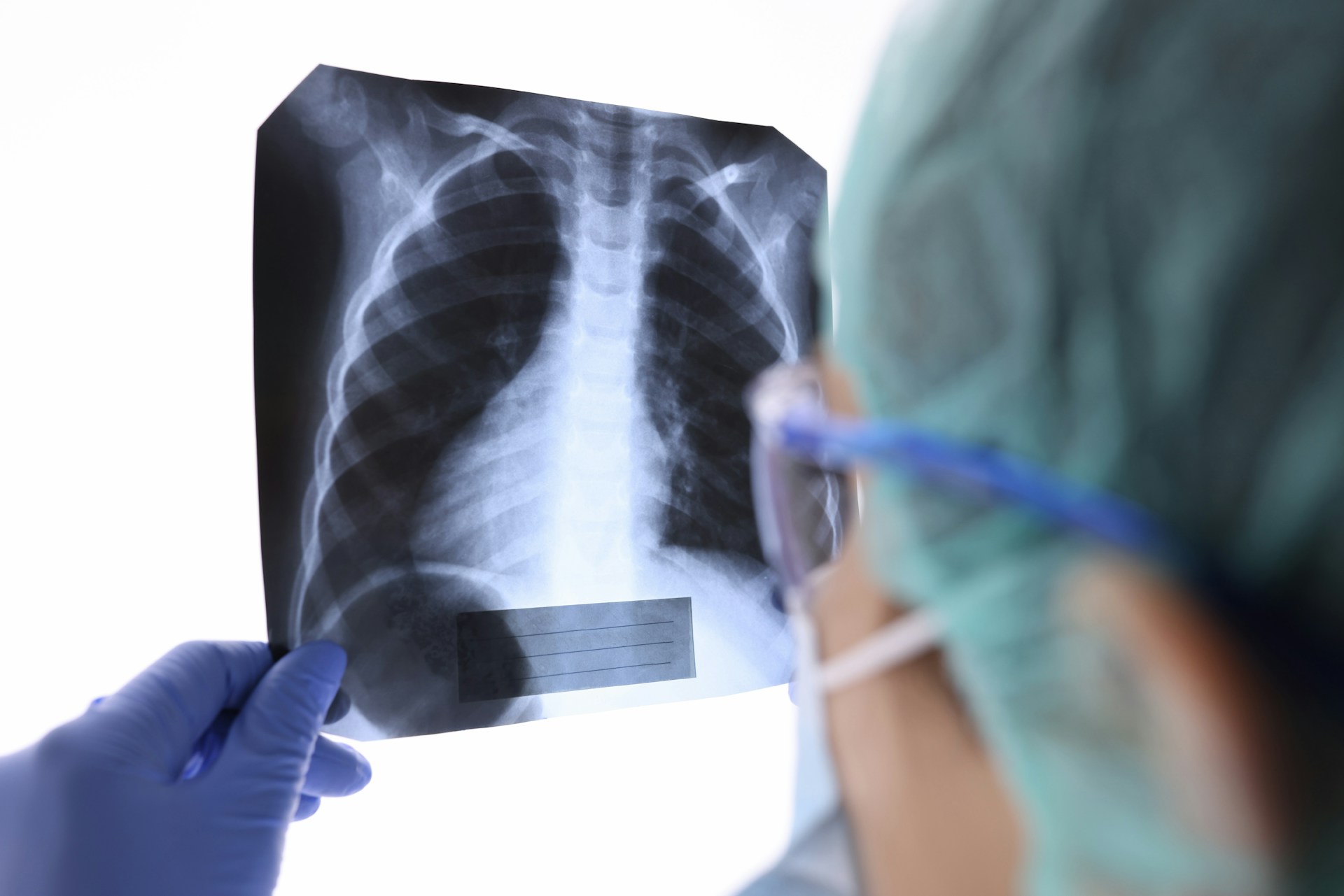 The Environmental Impact of Improper X-Ray Disposal in Pompano Beach
